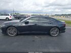 2025 Acura Tlx A-spec Package Black vin: 19UUB6F54SA003743