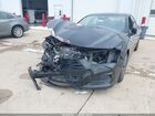 2025 Acura Tlx A-spec Package Black vin: 19UUB6F59SA003284