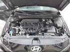 2026 Hyundai Elantra Sel Sport Черный vin: KMHLM4DG7TU112481 2026 Hyundai Elantra Sel Sport Черный vin: KMHLM4DG7TU112481