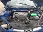 2017 Hyundai Veloster Value Edition Blue vin: KMHTC6AD2HU320879