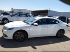 2017 Acura Tlx Technology Package White vin: 19UUB1F54HA002829