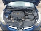 2016 Hyundai Elantra Se Синий vin: 5NPDH4AE4GH702069