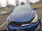 2016 Hyundai Elantra Se Синий vin: 5NPDH4AE9GH681235