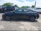 2024 Nissan Sentra Sv Xtronic Cvt Черный vin: 3N1AB8CV3RY257230 2024 Nissan Sentra Sv Xtronic Cvt Черный vin: 3N1AB8CV3RY257230